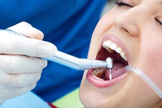 حشو الاسنان